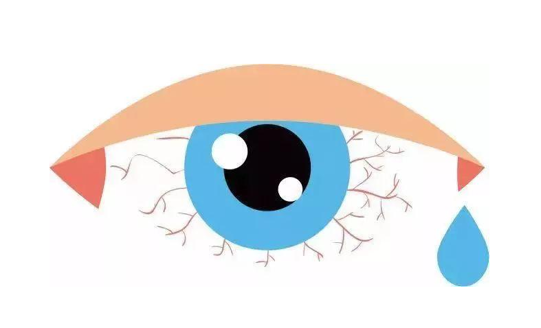 近视手术